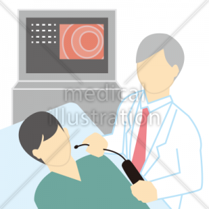 胃カメラ 内視鏡検査のイラスト 無料の医療イラスト素材